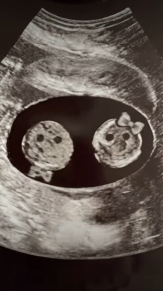 스크럽대디2 소마코